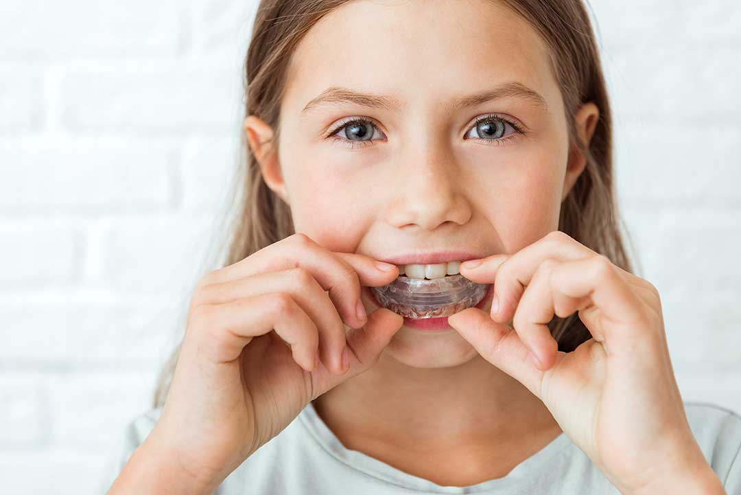 Myobrace for Children: A Natural Solution for Straight Teeth AR