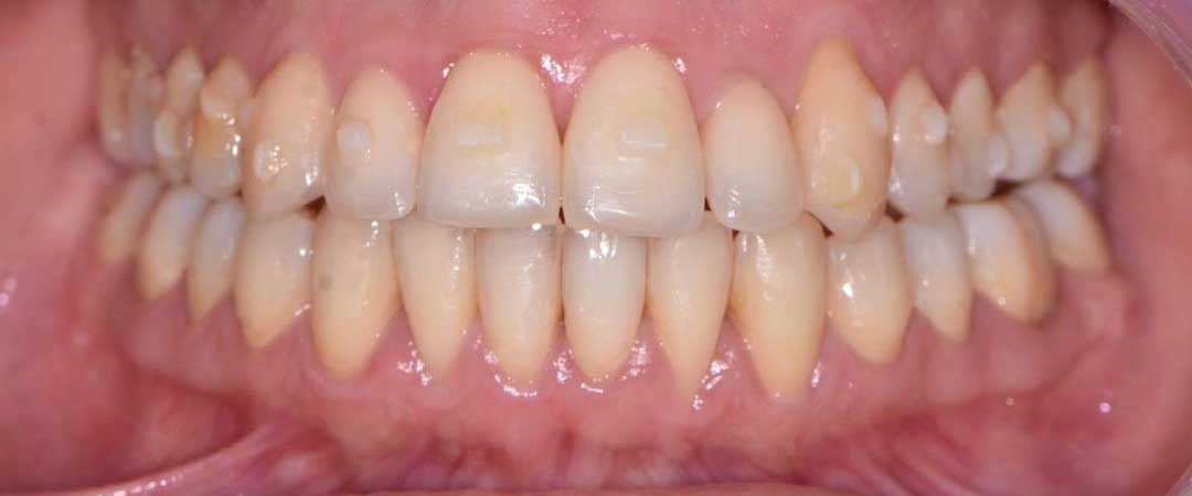 orthodontics near me