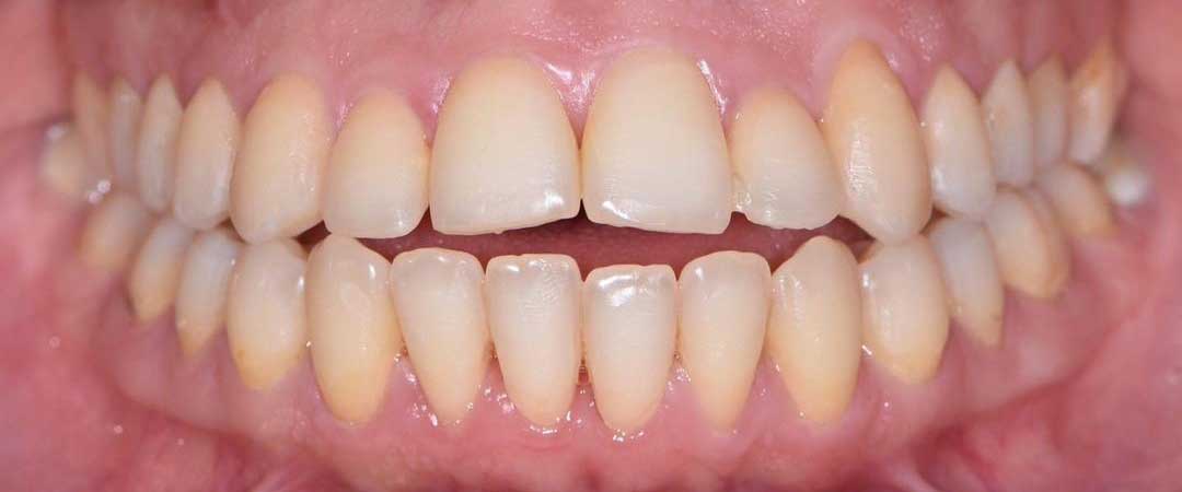 orthodontics near me