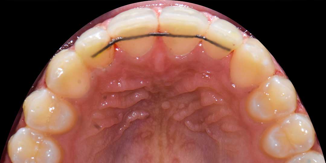 orthodontics abu dhabi