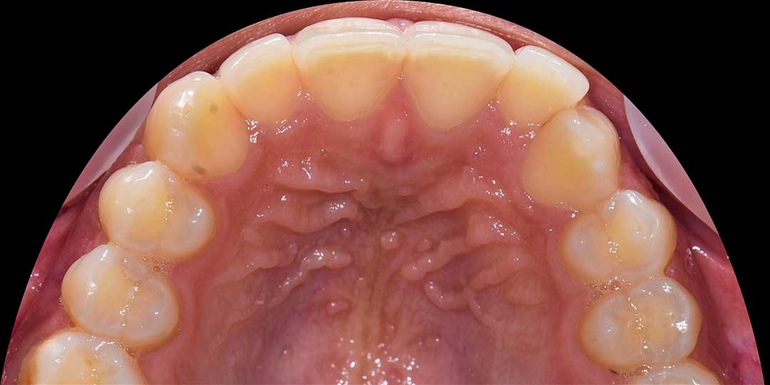 orthodontics abu dhabi