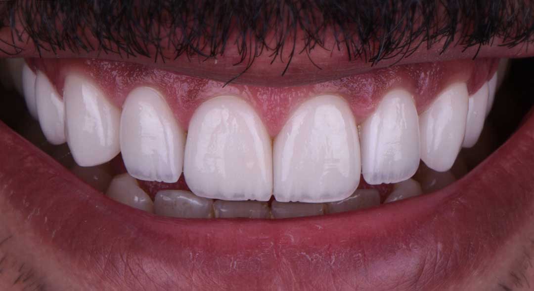 Prosthodontics near me