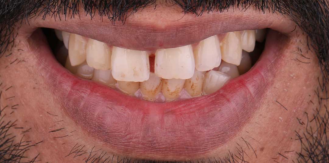 Dr rabee dayoub dentist near me