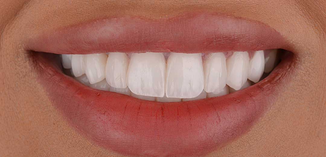 cosmetic dentist dubai