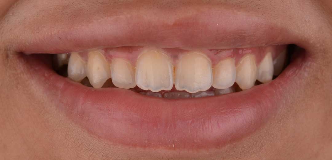 cosmetic dentist dubai