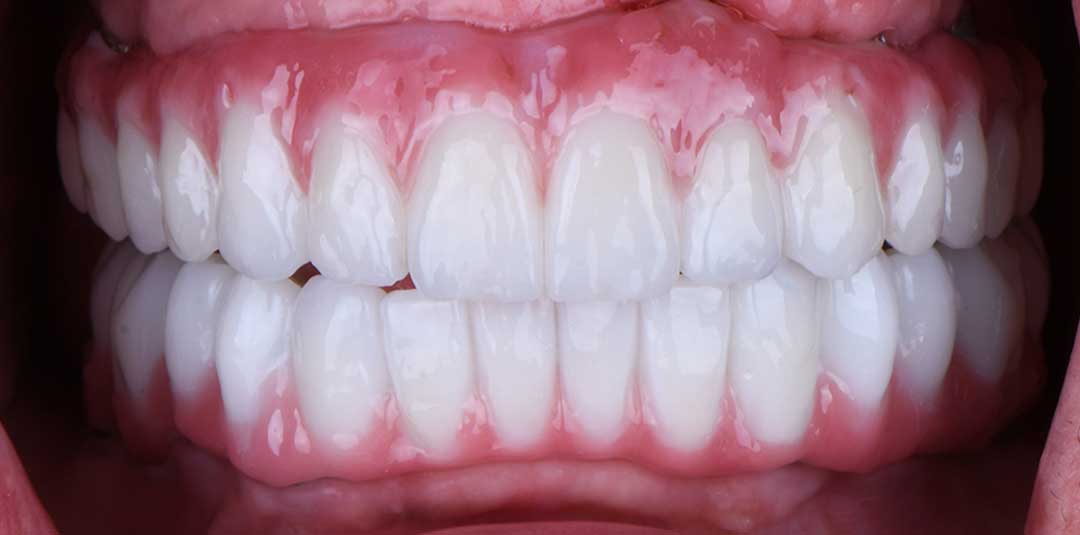 full mouth rehabilitation near me