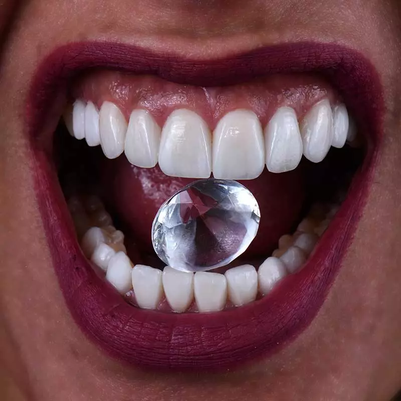 Smile restoration and prosthodontic treatment at Harmony Medical Center in dubai and abu dhabi