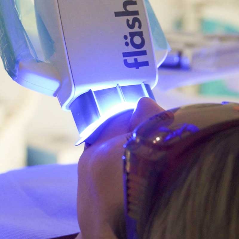 flash teeth whitening - harmony